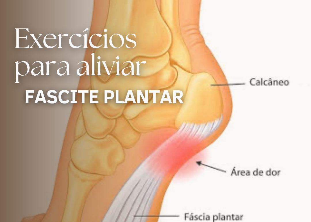 Ilustração anatômica do pé em corte lateral mostrando o calcâneo, osso do calcanhar, a fáscia plantar em branco percorrendo toda a sola até a base dos dedos, e em vermelho a área de dor onde a fáscia se insere no calcanhar.